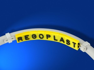 Die Befestigung am Kabel mit Edelstahlband und Kabelbinder